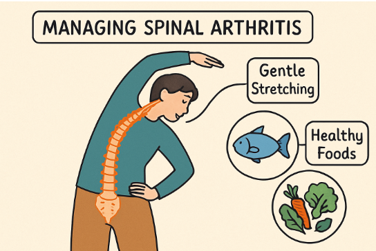 Living Well With Spinal Arthritis: Strategies for Minimizing Pain