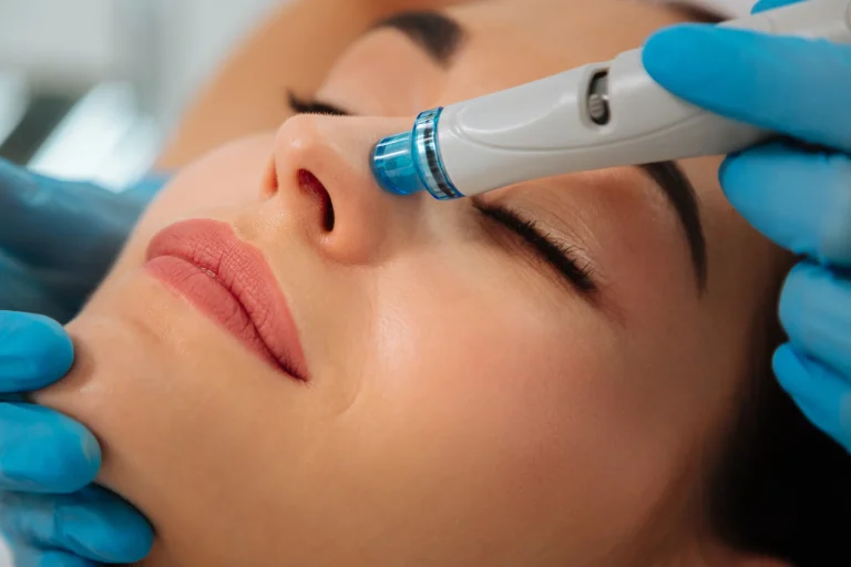 HydraFacial: A Comprehensive Guide to Radiant Skin